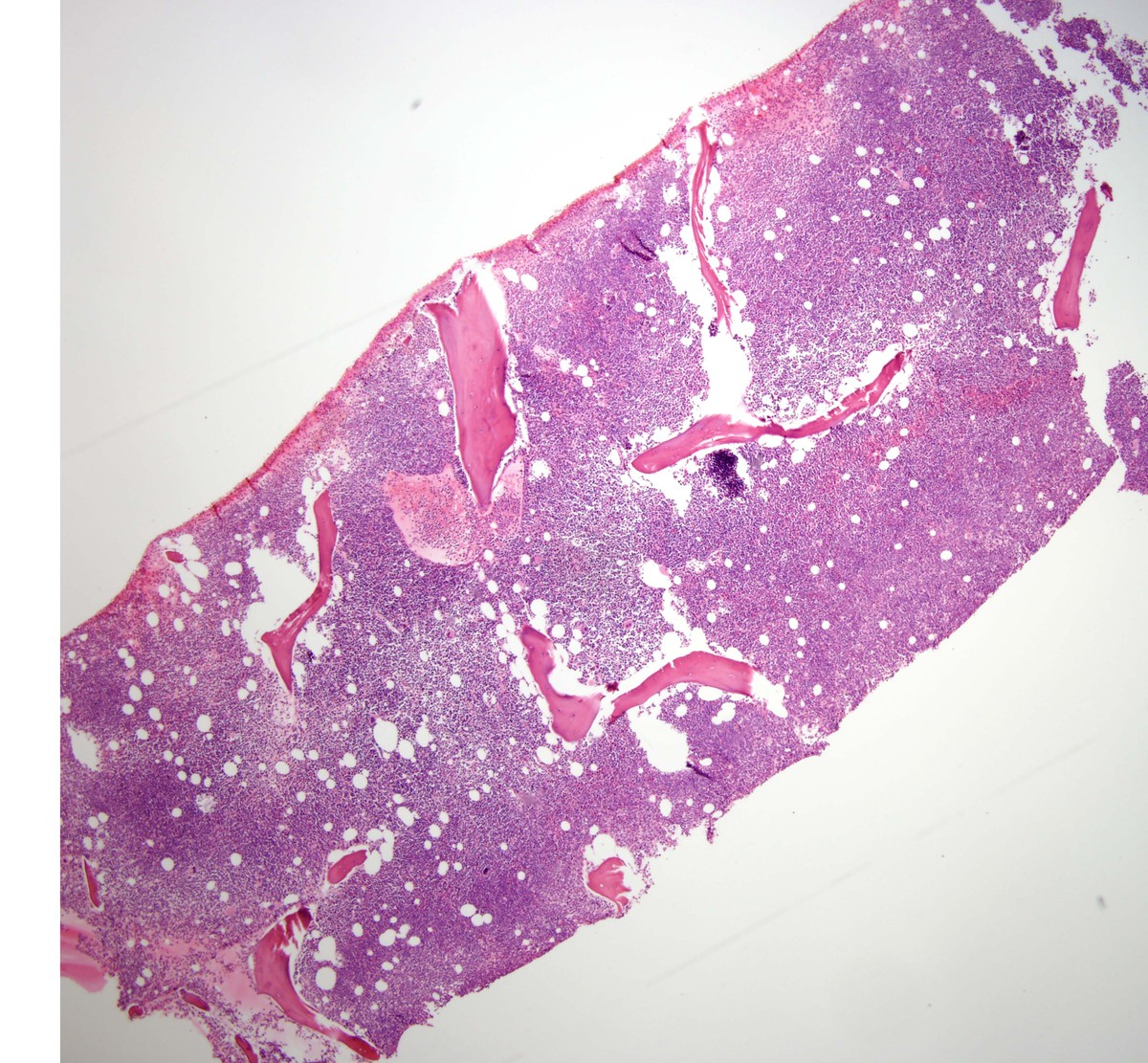 Biopsy core 40x